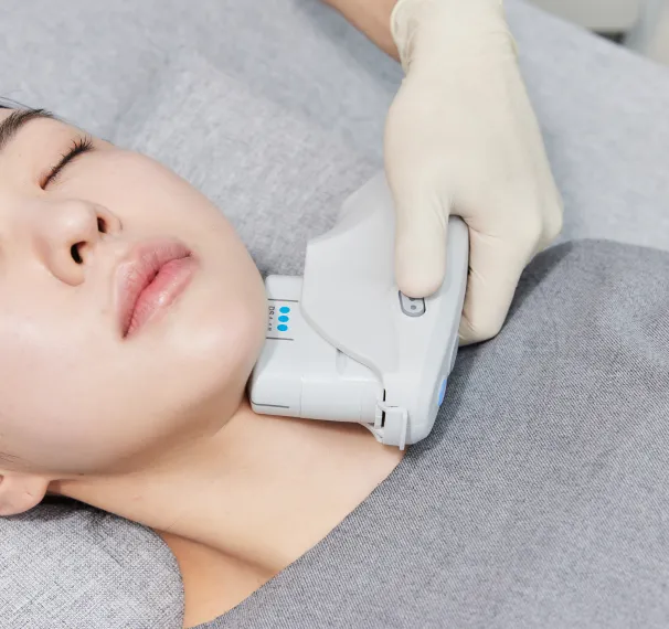 ULTHERAPY PRIME hover